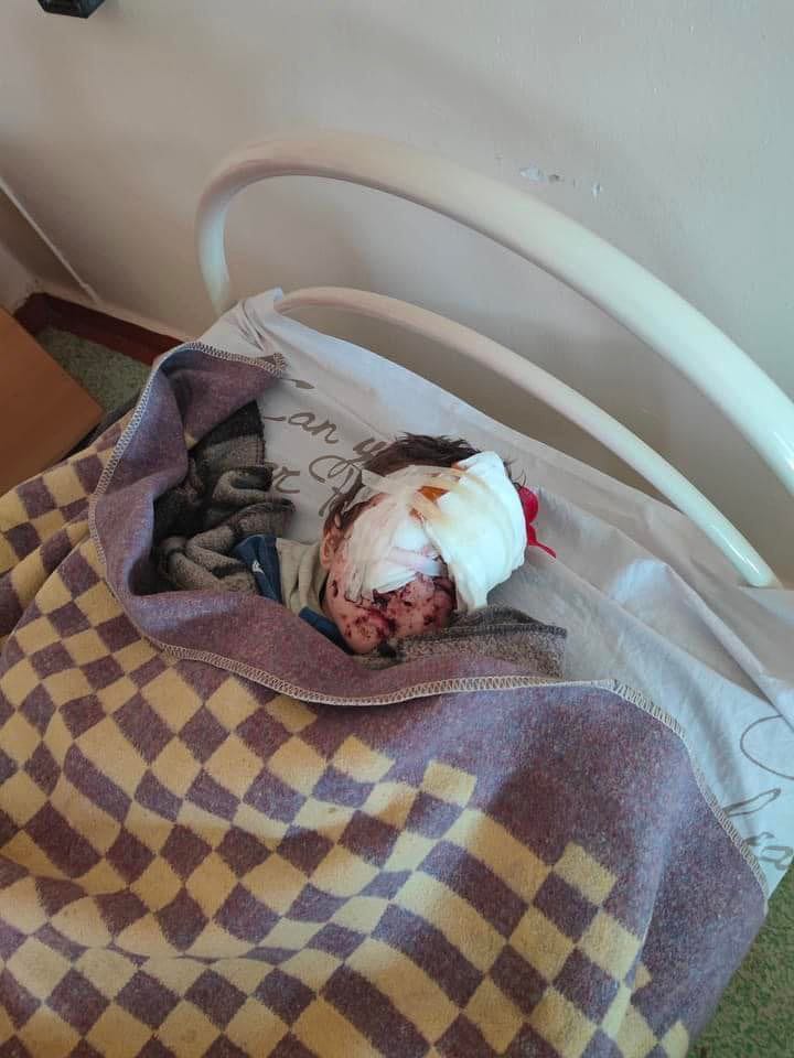 Severodonetsk, una mujer y sus hijos gemelos resultaron heridos en el bombardeo ruso